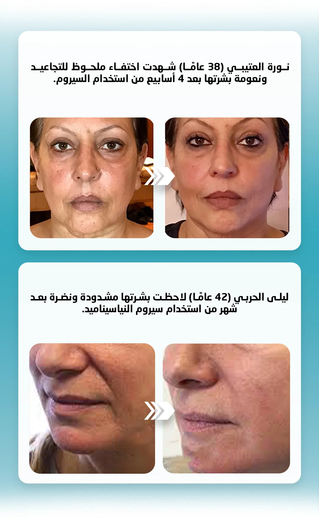 SERUM NIACINAMID (سيروم التجاعيد)